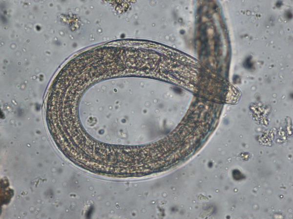 Padultworm
