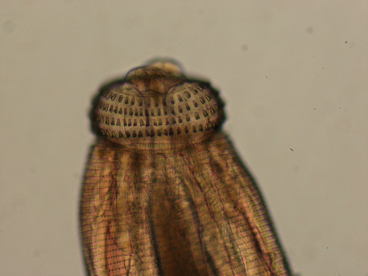 Gnathostoma - Larva (1)