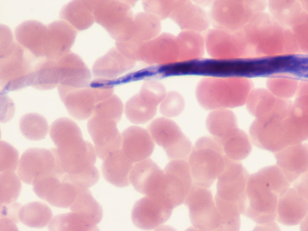 Microfilaria of Loa loa - African eye worm (1)