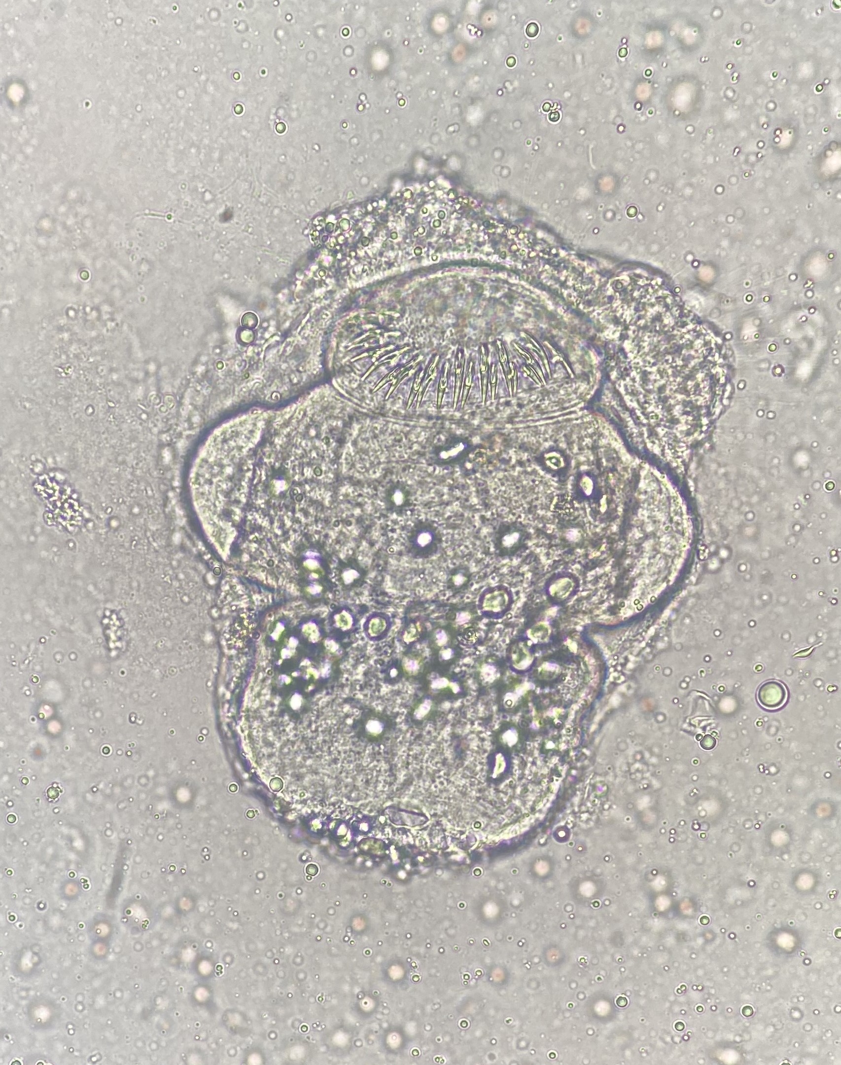 Protoscolex of Echinococcus granulosus - Hydatid